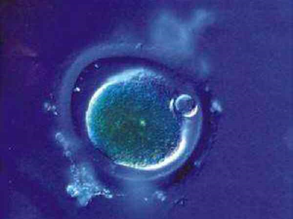 现在中国人做试管婴儿去哪国？专家解析全球热门目的地